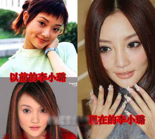 ���ƬF��Ƥ���z�Y Ů������Ę��׃��Ӳ